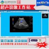 b超工作站 超聲影像工作站 彩超圖文工作站 巨渺科技