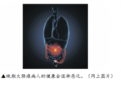 肠癌新标靶,疗效高  两类人士尽早筛查防止恶化